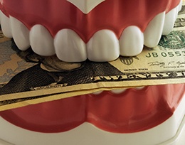 Dental model holding a stack of money