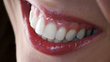 Closeup of smile with healthy gums