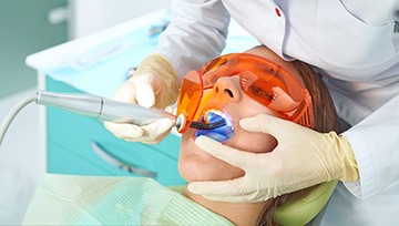 Dentist using curing light to harden composite resin 