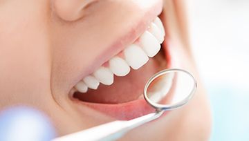 Up-close view of a person’s smile and tooth-colored fillings in Ann Arbor